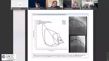 JACC: Case Reports | Video Case Presentation: Pressure-Volume Loop Analysis in PCI-Induced Shock