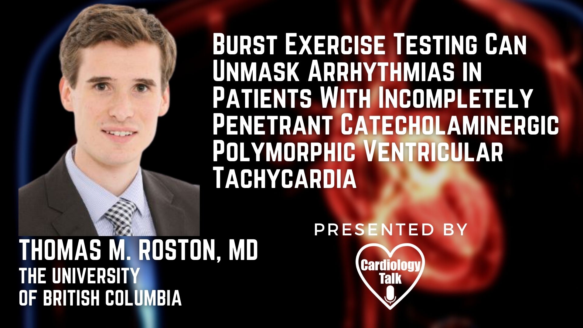 Thomas M. Roston, MD @AndrewKrahnMD @UBC #CPVT #Cardiology #Research Burst Exercise Testing Can Unmask Arrhythmias in Patients With Incompletely Penetrant CPVT