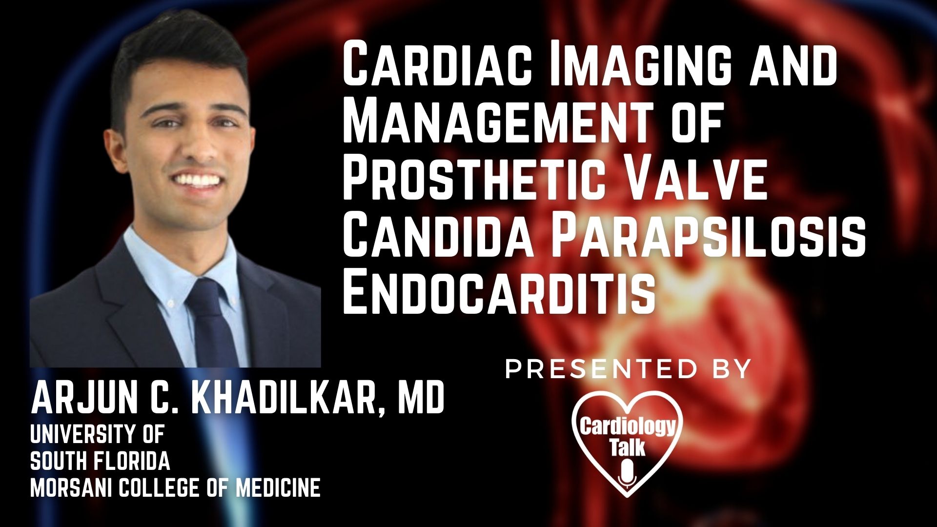 Arjun C. Khadilkar, MD @akhadilkarMD @USFHealthMed @USFIMres #PVEC #Cardiology #Research Cardiac Imaging and Management of Prosthetic Valve Candida Parapsilosis Endocarditis