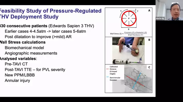 Dr. Martin Ng, MD- Novel Pressure-Regulated Deployment Strategy for Improving the Safety & Efficacy of Balloon-Expandable Transcatheter Aortic Valves