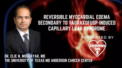 Dr. Elie N. Mouhayar, MD- Reversible Myocardial Edema Secondary to Tagraxofusp-Induced Capillary Leak Syndrome @EMouhayar @MDAndersonNews #MyocardialEdema #Cardiology #Research