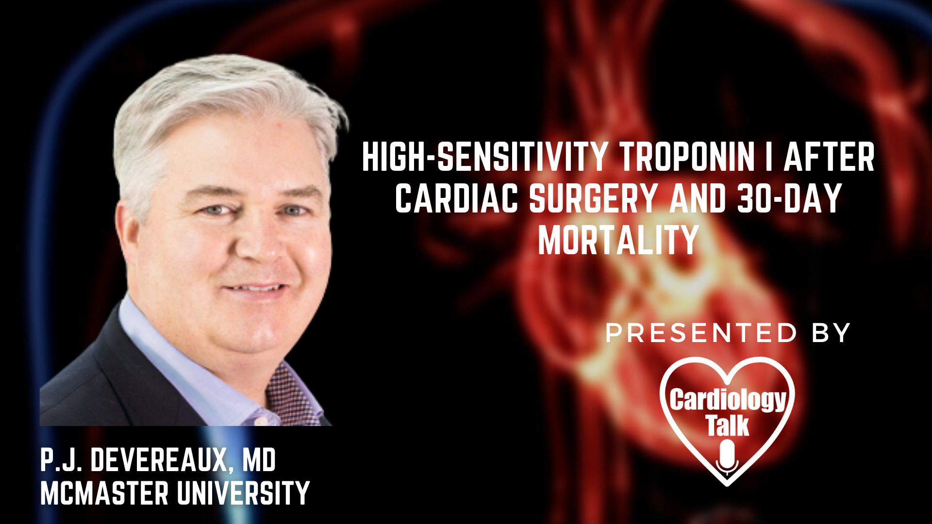 P.J. Devereaux, MD- High-Sensitivity Troponin I after Cardiac Surgery and 30-Day Mortality @PHRIresearch @MacDeptMed #Troponin #CardiacSurgery